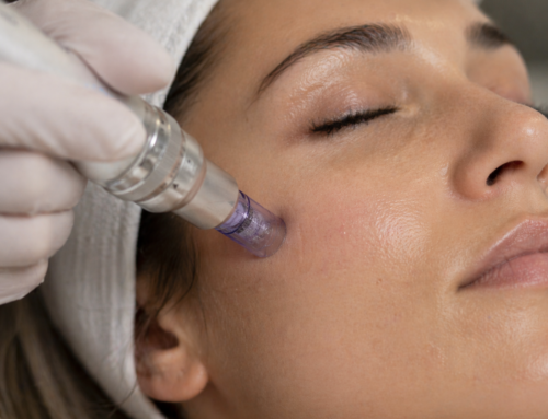 Microneedling in Preston | Skin Rejuvenation at Defyne Aesthetics Skin and Laser Clinic
